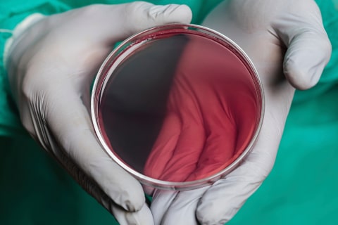 Close-up of a surgical wound area protected by a glowing barrier or shield effect.
