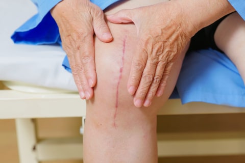 Illustration showing rapid tissue being absorbed.