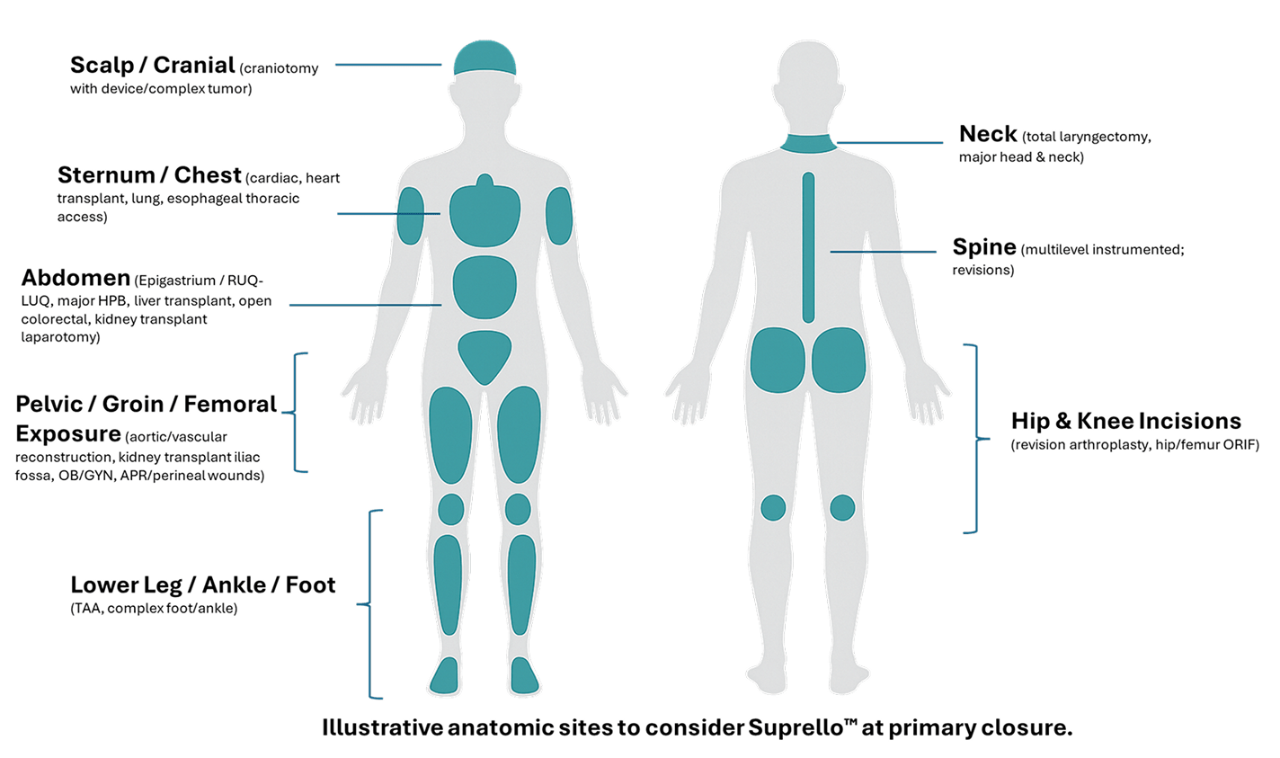 Illustration of human body highlighting anatomic sites.
